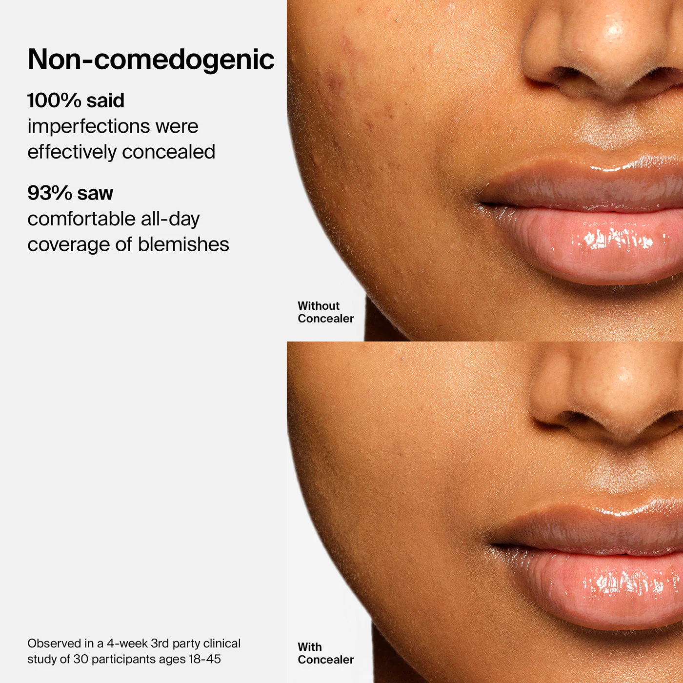 Triclone™ Skin Tech Concealer - Image 106